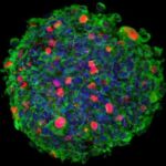 Imagen 3D de inmunomicroscopía confocal de una neuroesfera originada por células madre aisladas de un paciente de glioblastoma (GSC), e infectadas por el parvovirus MVM (Minute Virus of Mice)