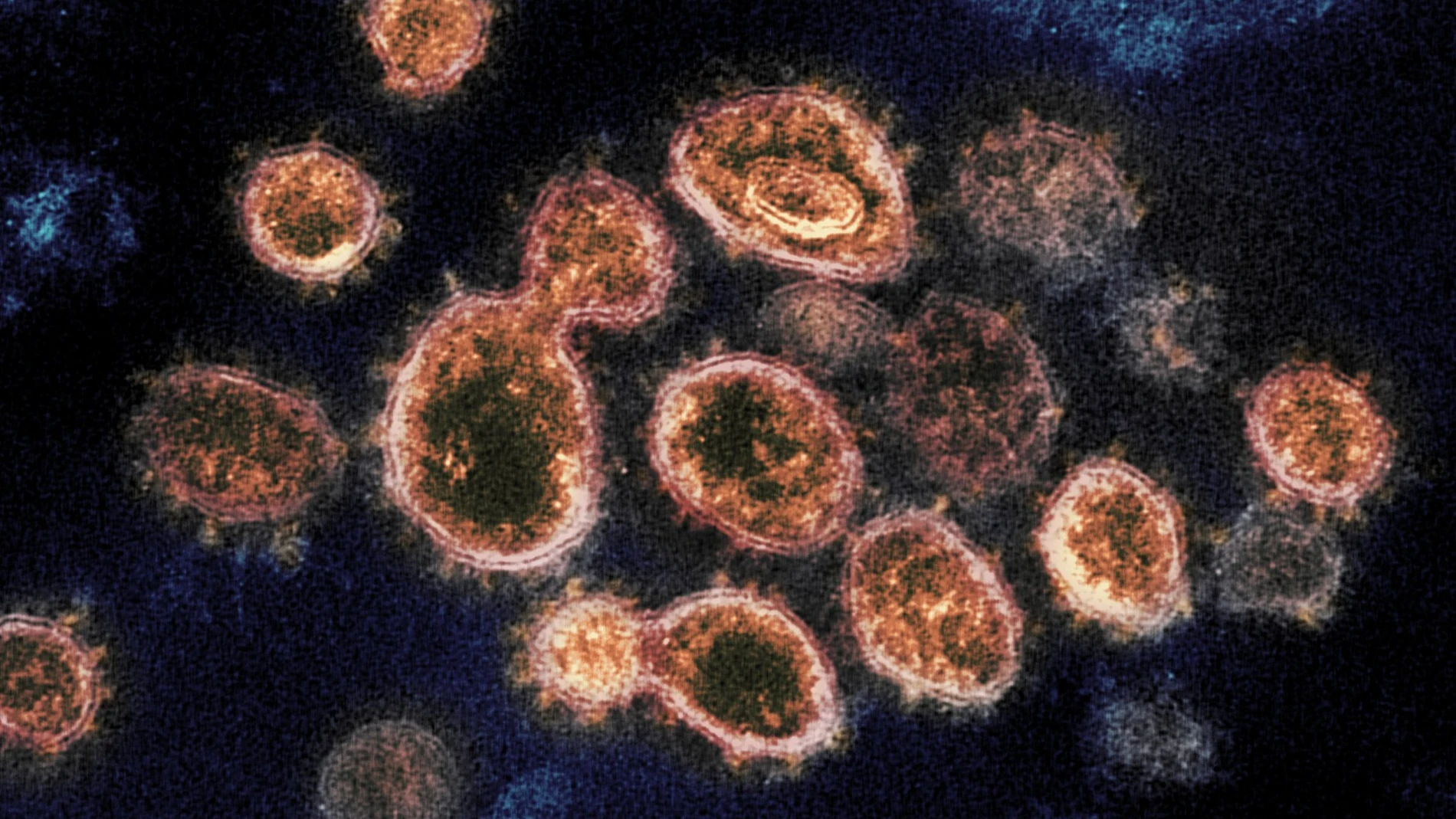 Virus del SARS-CoV-2