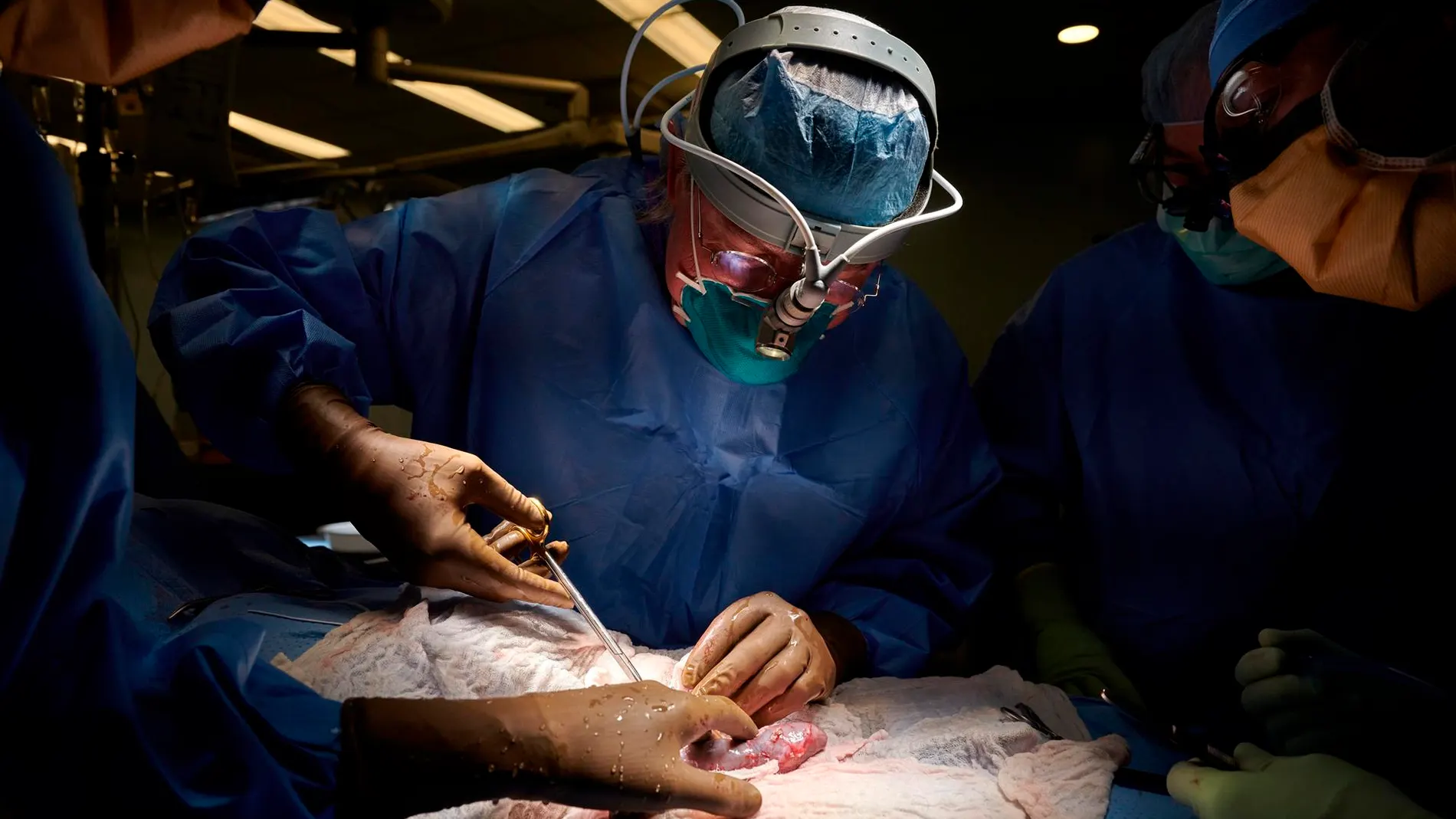 Un equipo de cirugía operando en un quirófano