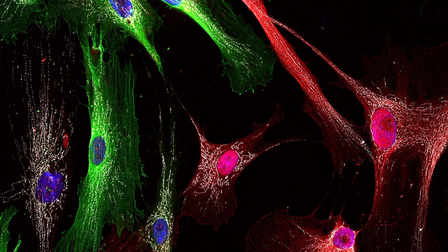 “Las células se ayudan entre sí”, ha recibido el premio del Jurado del I Concurso de Fotografía Científica del Instituto de Neurociencias UMH-CSIC