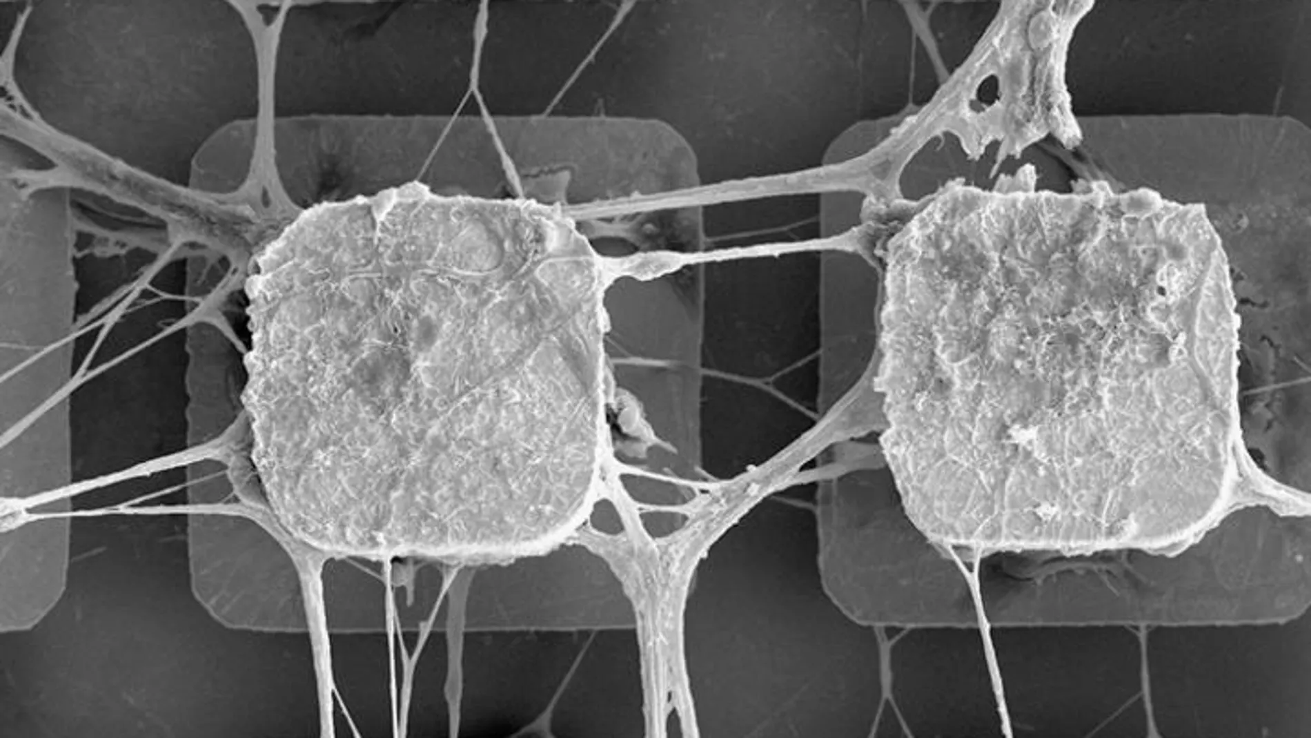 Neuronas en un microchip