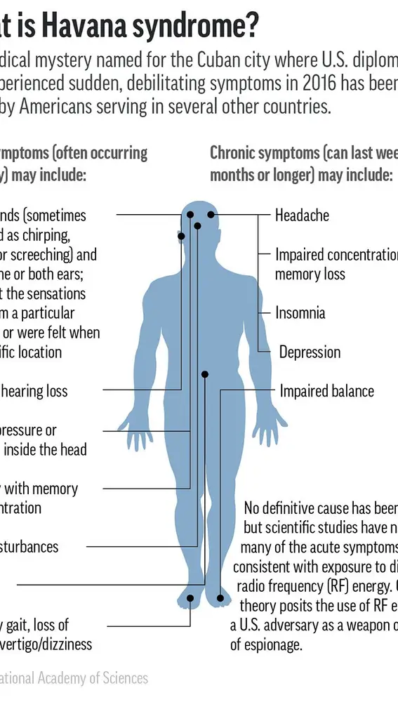 Symptoms associated with Havana syndrome, which has afflicted Americans serving at diplomatic posts in several countries. (AP Graphic)