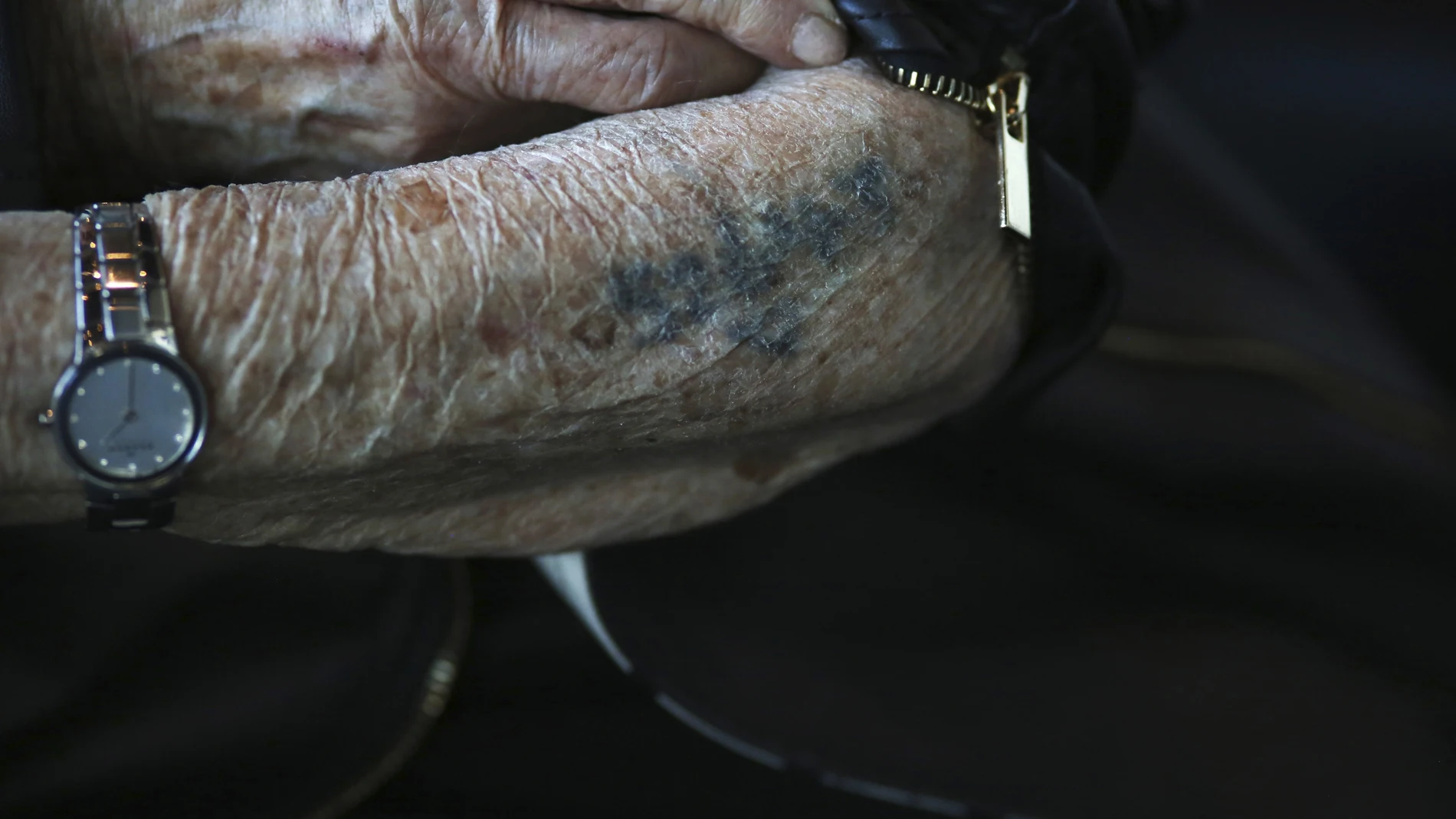 El brazo de Bronia Brandman, superviviente del Holocausto, marcado por los tatuajes distintivos de los nazis