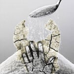 Sufrir diabetes duplica el riesgo de depresión y adelanta la aparición de demencias