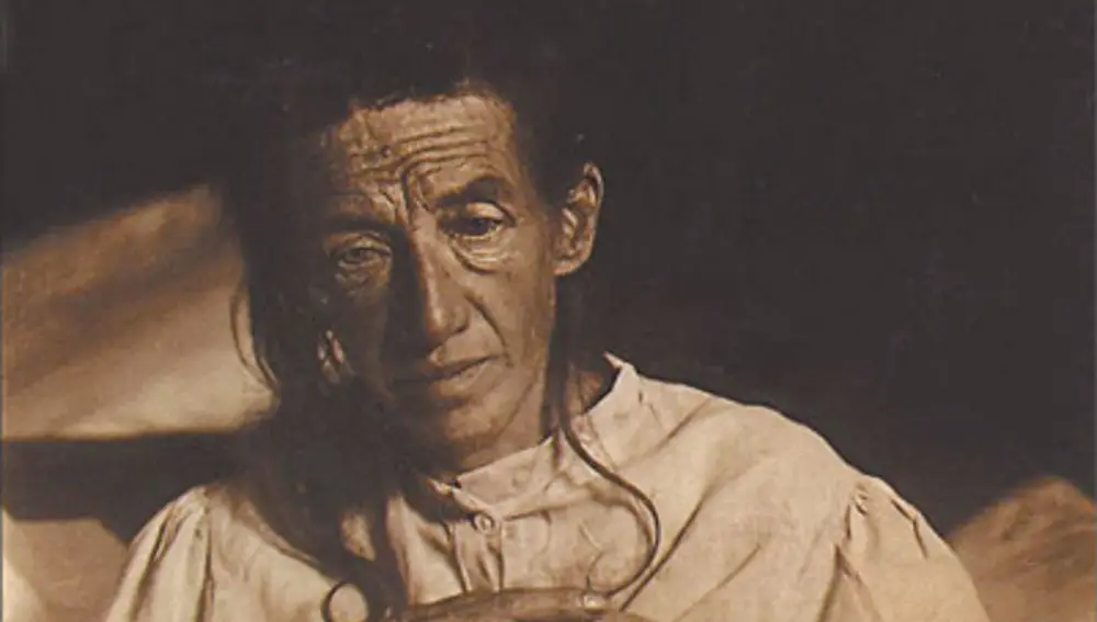 Auguste Deter, la primera paciente diagnosticada de Alzheimer
