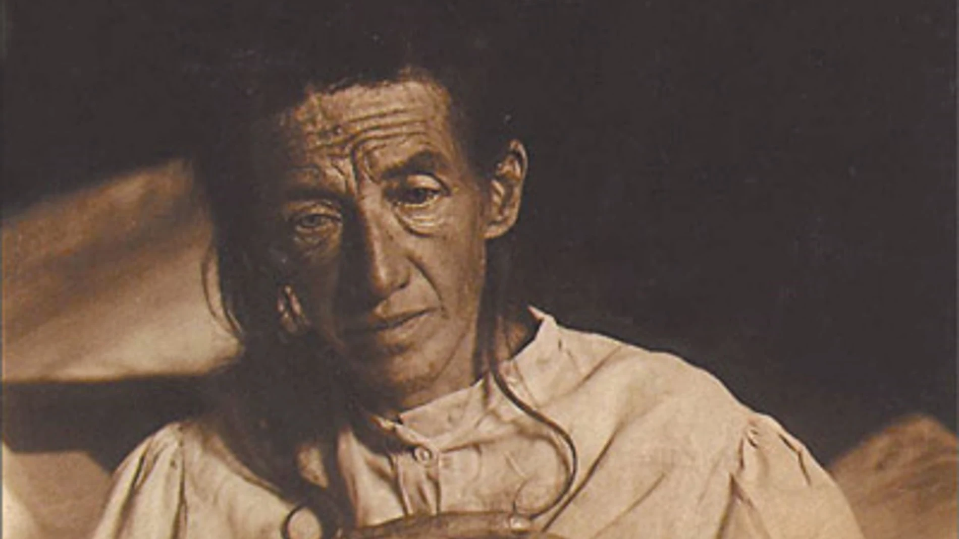 Auguste Deter, la primera paciente diagnosticada de Alzheimer