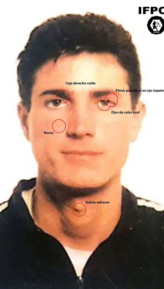 Las peculiaridades del rostro de Antonio Anglés que han tenido en cuenta los investigadores