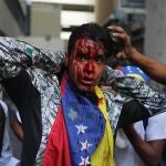 Un manifestante herido durante enfrentamientos con la Policía Nacional Bolivariana participa durante una protesta contra el presidente de Venezuela, Nicolás Maduro.