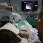 Un paciente se somete a una broncoscopia para realizar una biopsia de pulmón