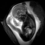 .El Instituto de Neurociencias Universidad Miguel Hernández-CSIC está al cargo del estudio