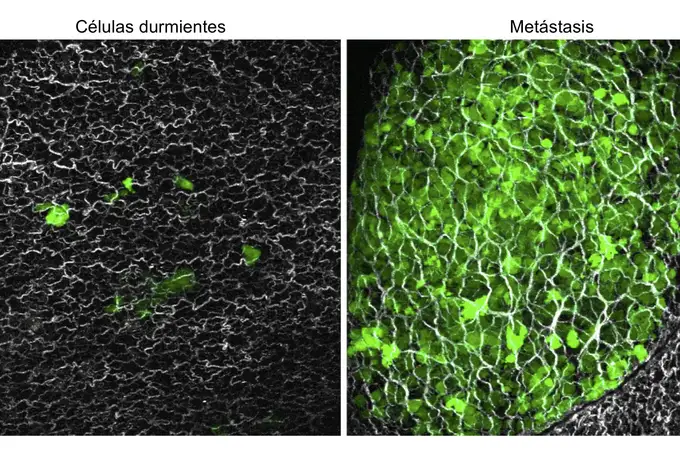 Una investigación española abre una vía para predecir si un cáncer hará metastasis en el cerebro