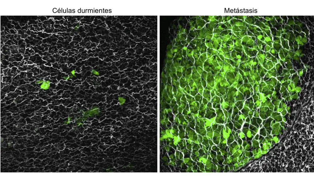 Pulmones de ratón donde se visualiza células durmientes (izq.) y con metástasis (dcha.)