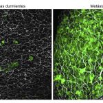Pulmones de ratón donde se visualiza células durmientes (izq.) y con metástasis (dcha.)