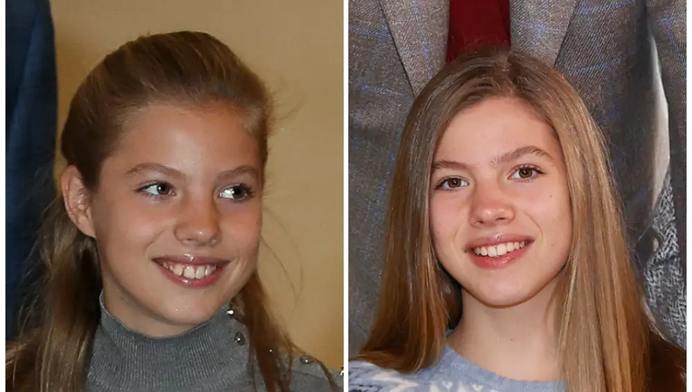 La Infanta Sofía, antes y después de usar ortodoncia