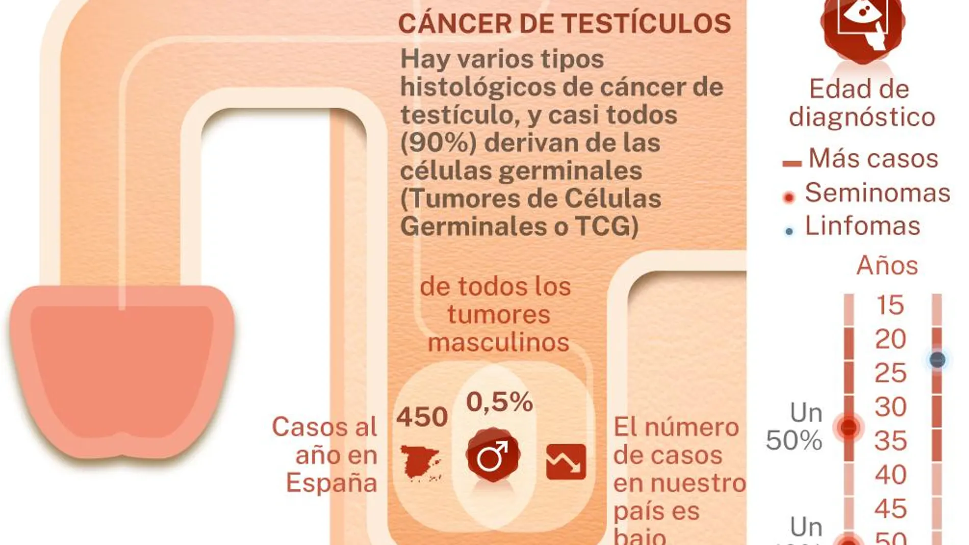 Cáncer testicular. Infografía
