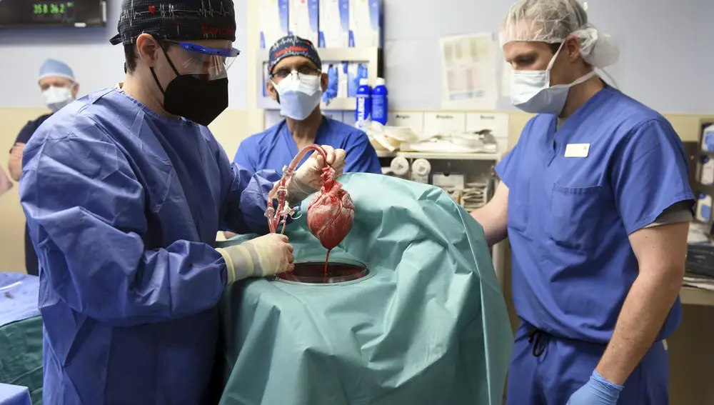 En esta foto proporcionada por la Facultad de Medicina de la Universidad de Maryland, miembros del equipo quirúrgico muestran el corazón de cerdo para el trasplante al paciente David Bennett