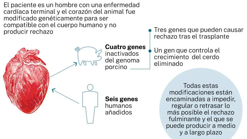 Trasplante de corazón porcino a un ser humano