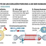 Pasos seguidos para un trasplante de corazón porcino a un humano