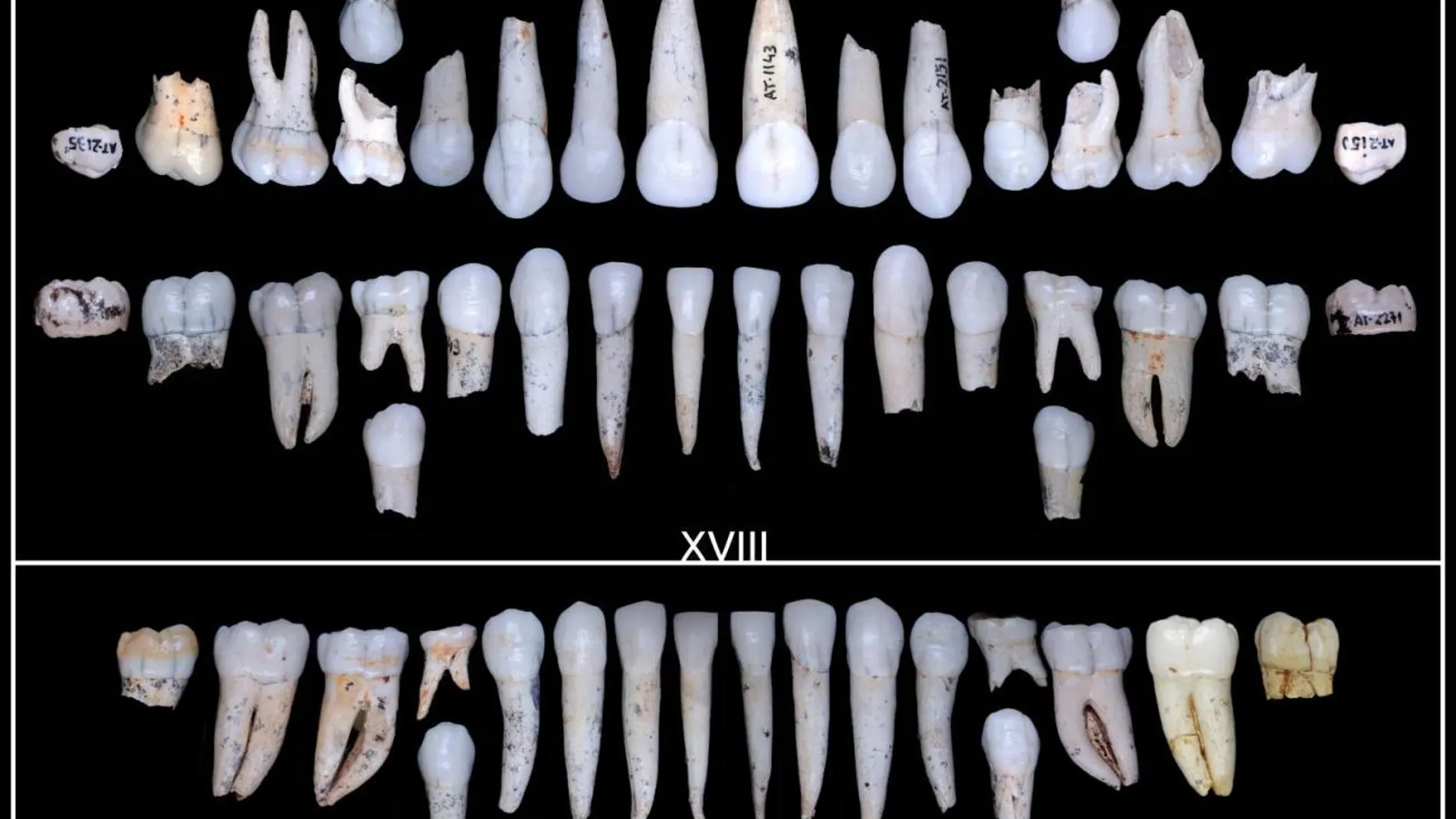 Dientes pertenecientes al individuo XVIII (arriba) y XXV (abajo) de la Sima de los Huesos