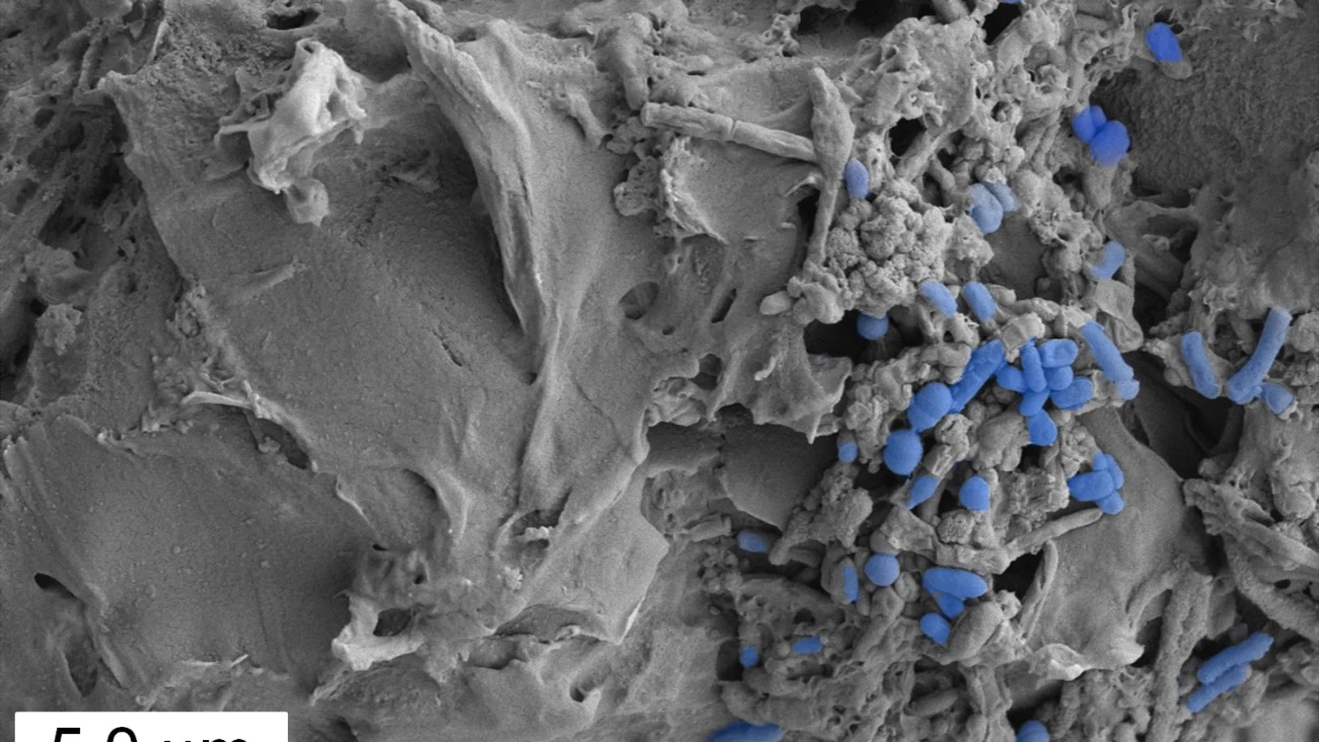 Imagen microscópica de microplásticos colonizados por la microbiota intestinal