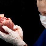 Los investigadores estudian ahora un tratamiento que elimina de forma selectiva e inocua uno de los anticuerpos causantes del deterioro de las válvulas biológicas