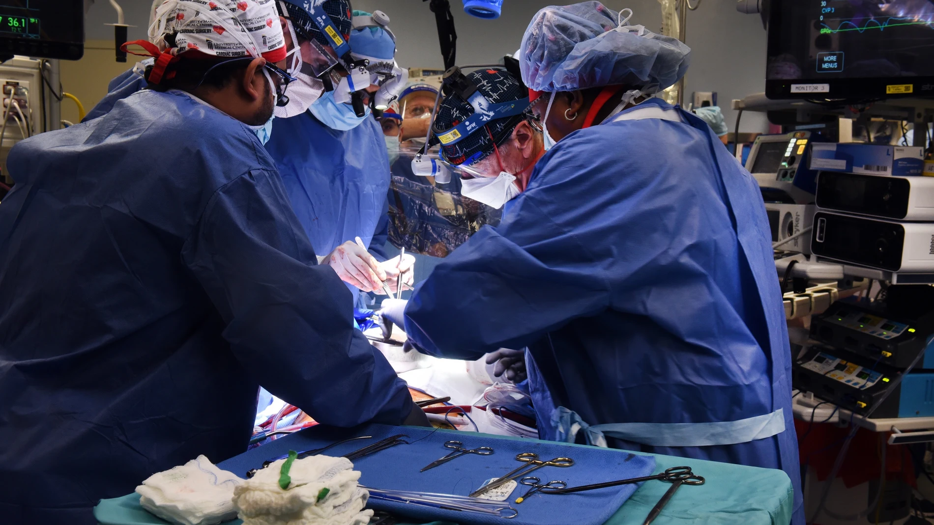 El cirujano Bartley P. Griffith y su equipo, que desarrolló con éxito el trasplante temporal del corazón de un cerdo geneticamente modificado a un paciente de 57 años en muerte cerebral