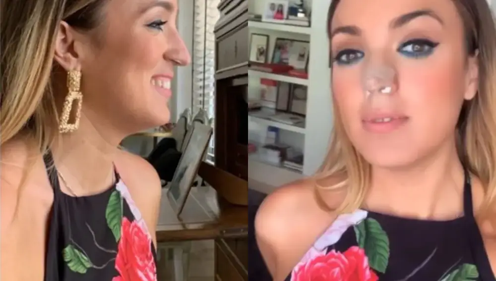 El antes y después de la operación estética de Marta Riesco