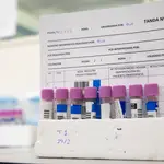 El laboratorio de las 500.000 PCR