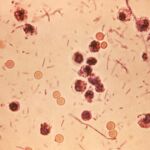 Microfotografía de heces en un paciente con shigelosis, que también se conoce como "disentería por Shigella" o "disentería bacteriana" | Dominio Público