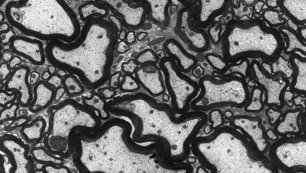 En ratones sanos, la mielina aislante (en negro) se ajusta cómodamente como una capa compacta alrededor de las fibras nerviosas, los axones