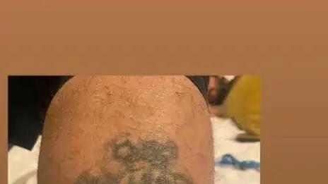 El tatuaje en el gemelo de la Mano de Dios