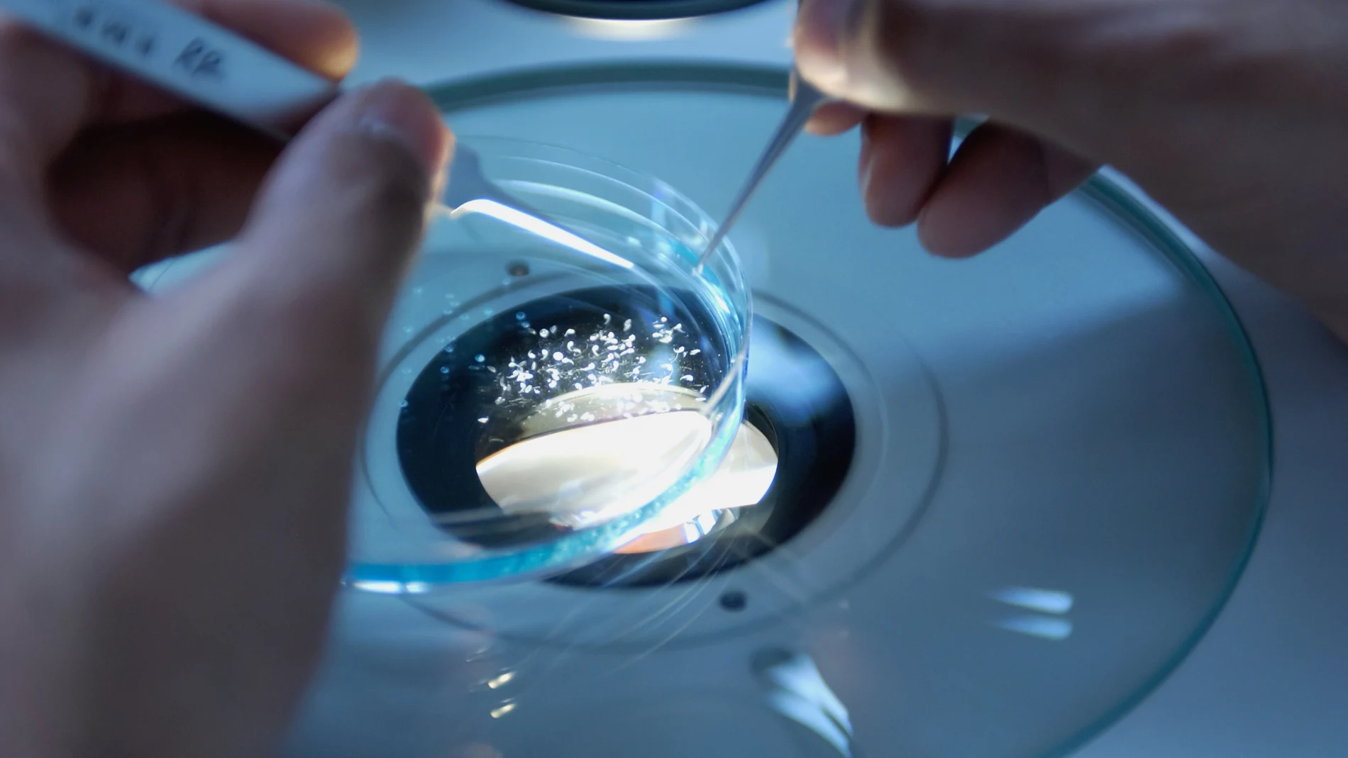 La frecuencia de la ICD en España no está suficientemente caracterizada, pero la elevada y creciente utilización de los antibióticos de amplio espectro son factores que favorecen el crecimiento de esta enfermedad.