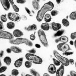 Bacteria Coxiella burnetii