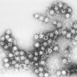 Virus Coxsackie