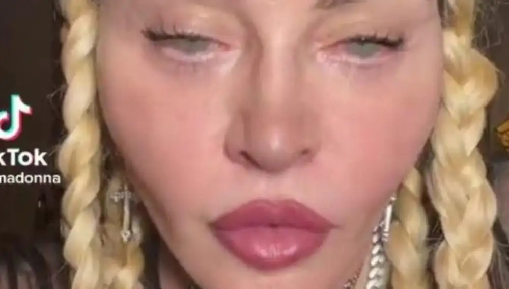 Nuevo rostro de Madonna
