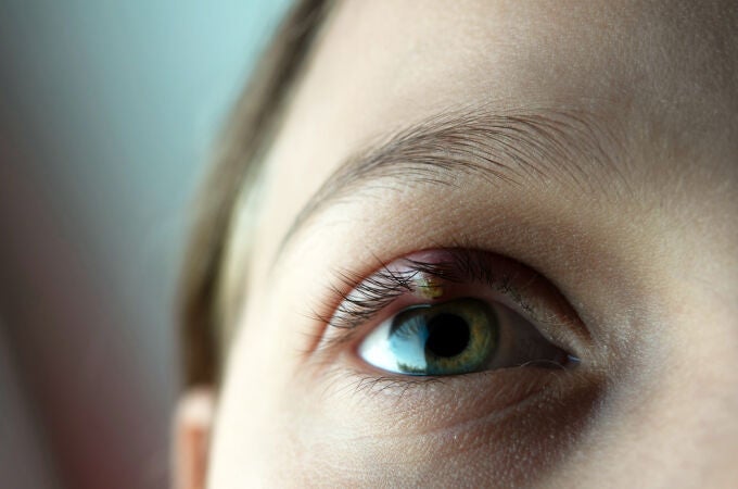 Las patologías oculares se han multiplicado estos últimos dos años