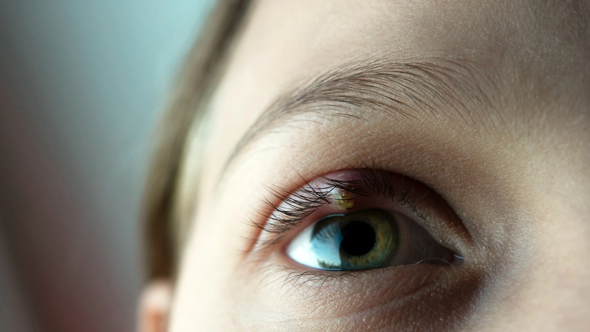 Las patologías oculares se han multiplicado estos últimos dos años