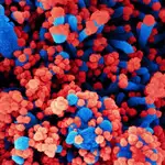 Micrografía electrónica de barrido de células humanas (azul) infectadas con SARS-CoV-2 (rojo)