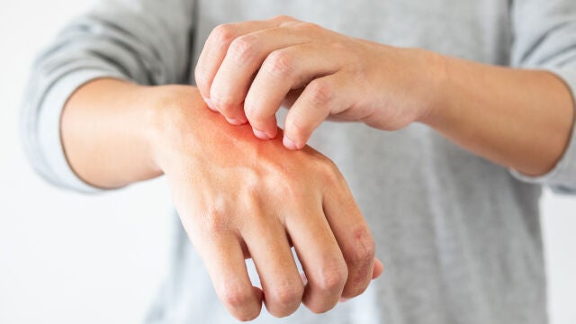 El rascarse podría tener beneficios para el cuerpo