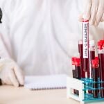Laboratorio con muestras de sangre