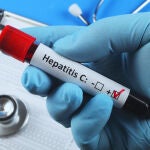 Test de detección de la hepatitis C