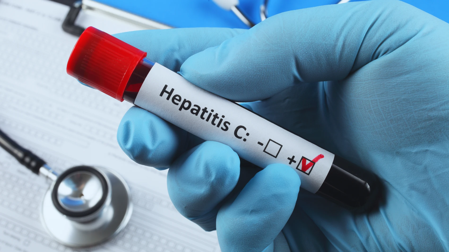 Test de detección de la hepatitis C