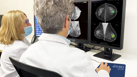 Profesionales sanitarios examinan unas pruebas de una paciente afectada por un cáncer de mama