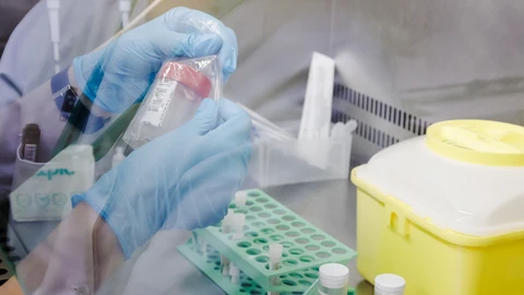 Una enfermera sostiene una de las pruebas de análisis para la viruela del mono, en el Hospital Ramón y Cajal