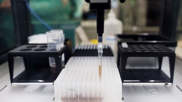 Probetas de pruebas PCR en el Laboratorio de Microbiología del Hospital público Gregorio Marañón