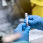 Procesamiento de muestras para PCR de la viruela del mono
