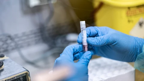 Procesamiento de muestras para PCR de la viruela del mono