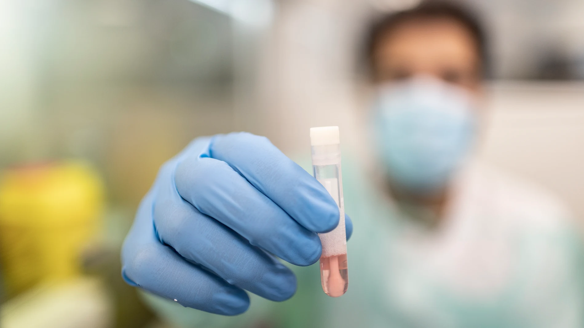 Procesamiento de muestras para PCR de Monkeypox