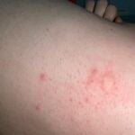 Los vecinos de Lorca denuncia el problema de las plagas de mosquitos por todo el municipio