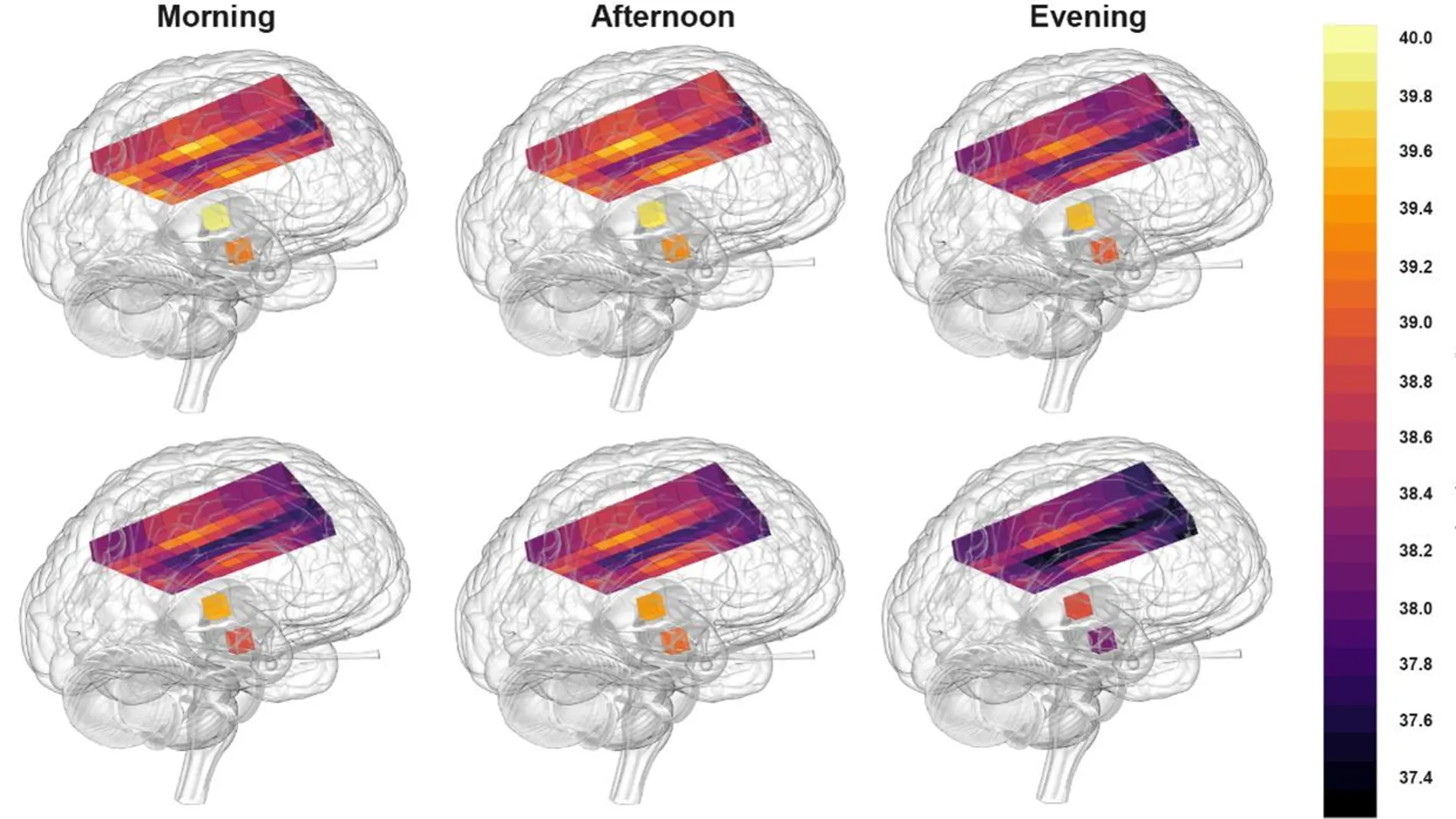 Resonancia magnética donde se muestran distintas temperaturas medidas en el cerebro de mujeres justo antes de ovular (arriba), hombres (abajo) y, por columnas de izquierda a derecha, en función de si fueron analizados por la mañana, por la tarde o ya al anochecer.